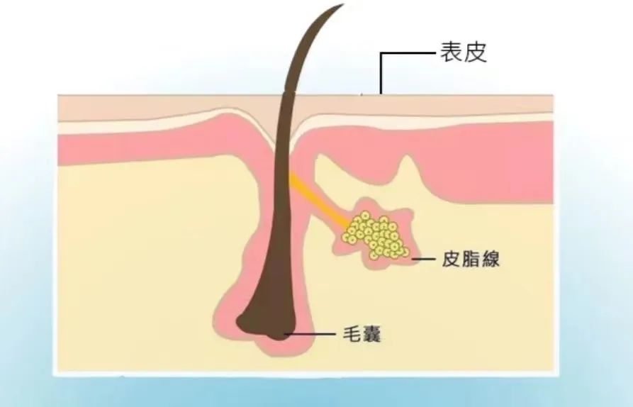 拒做人间*物尤**！这3招控油秘诀我真的吹爆