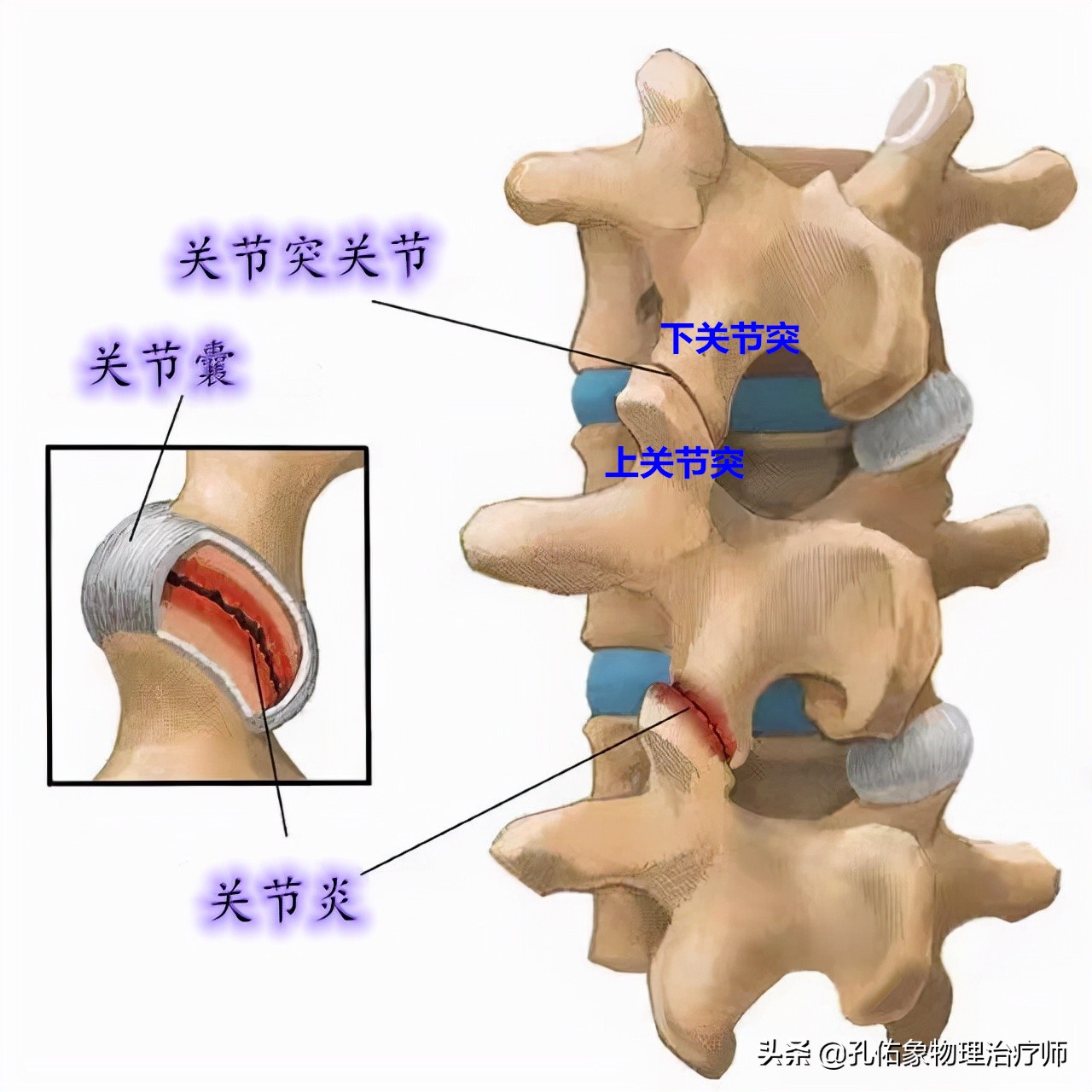 神经根颈椎病的症状和治疗方法,椎动脉颈椎病的症状和治疗方法