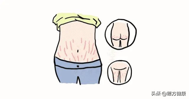 女性分娩经历的痛苦,妈妈生孩子的痛苦经历