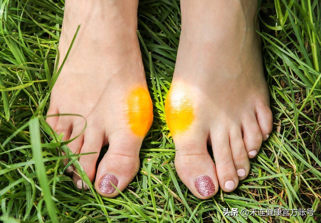 大脚趾凸起疼痛怎么回事,如何预防大脚趾凸出疼痛