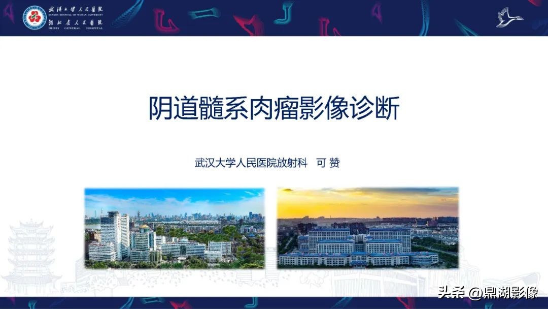 阴道肉瘤的早期症状,阴道里长肉瘤是啥症状