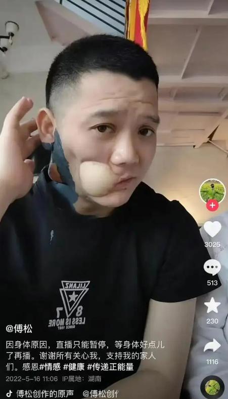 槟榔里的什么成分让人成瘾,槟榔大概吃多少才会成瘾