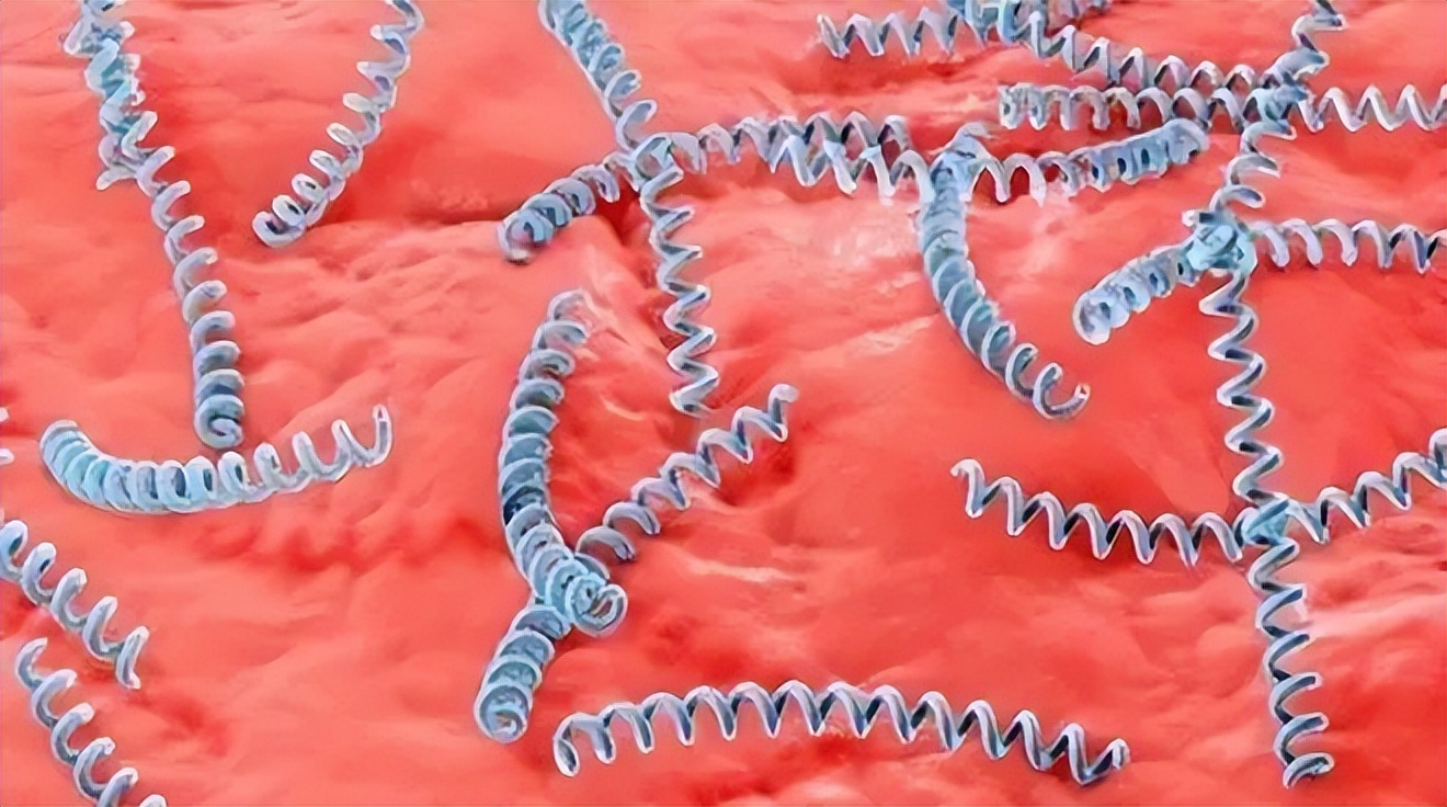 女博士疑因洁牙染梅毒怎么处理,女博士去牙科诊所感染梅毒