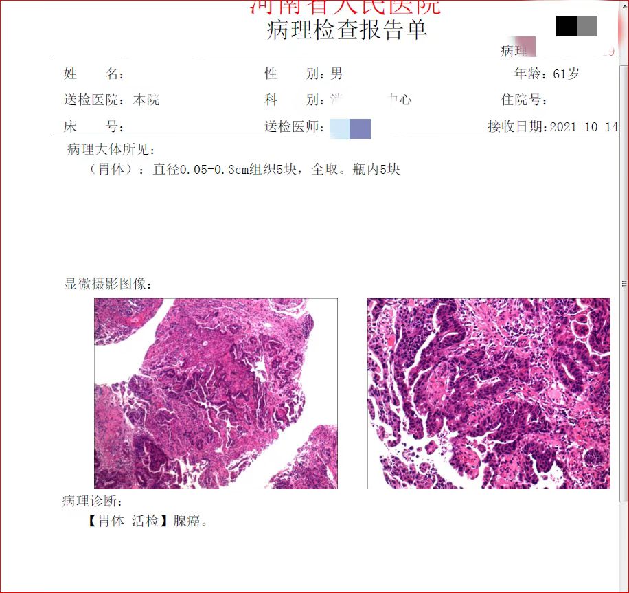 助力癌症康复,胃癌晚期转化治疗成功案例