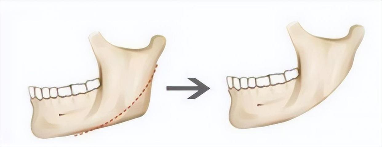 娱乐圈的整容脸,为什么娱乐圈那么多整容脸