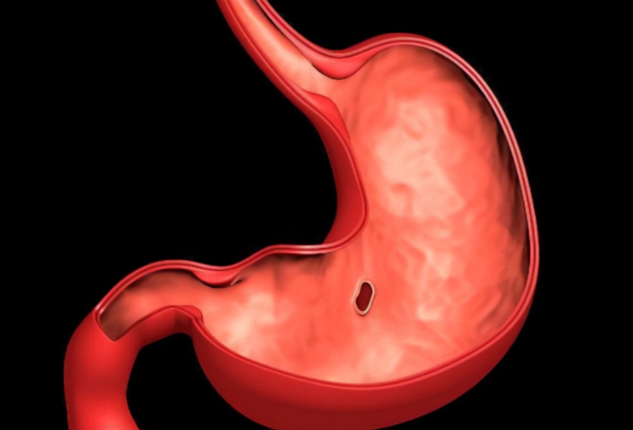 胃痛需要做胃镜检查吗,普通的胃痛必须做胃镜检查吗