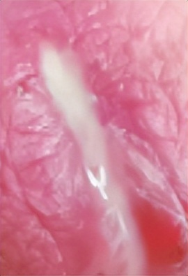 嫖娼后，怎么知道自己有没有染病？