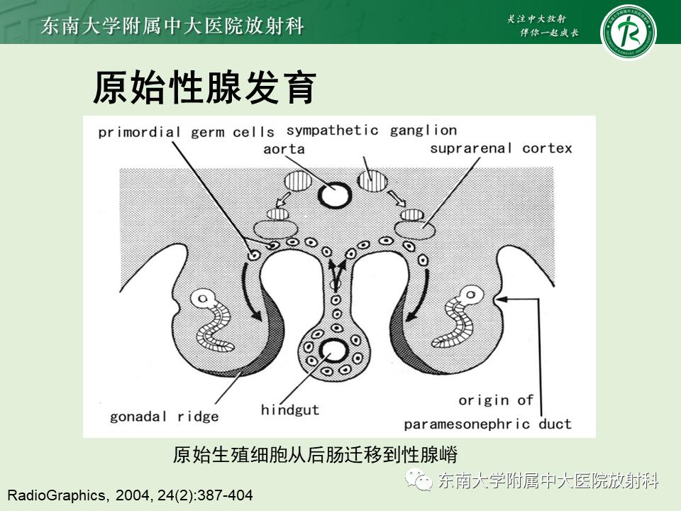 好文分享值得深思,纵隔精原细胞瘤
