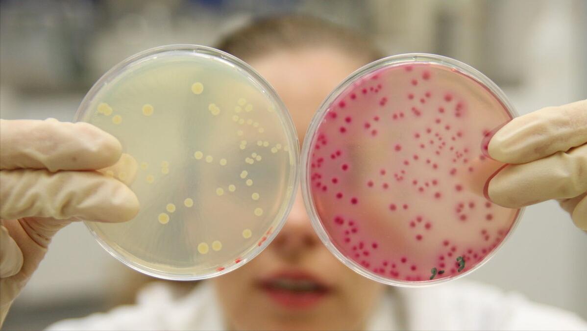 滴虫性阴道炎霉菌性阴道炎啥症状,霉菌性阴道炎塞药后多久症状消失