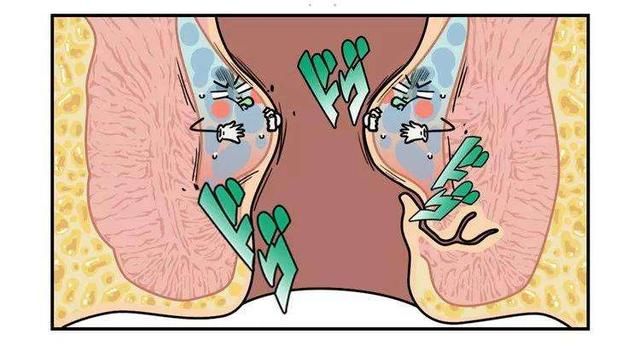 你有清洗“肛门”的习惯吗？一直这样做，或有这4个改变，别害羞