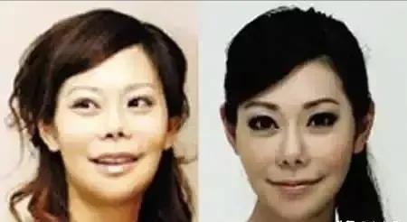 盘点那些整容整的最厉害的人,整容整的最厉害的三位女士