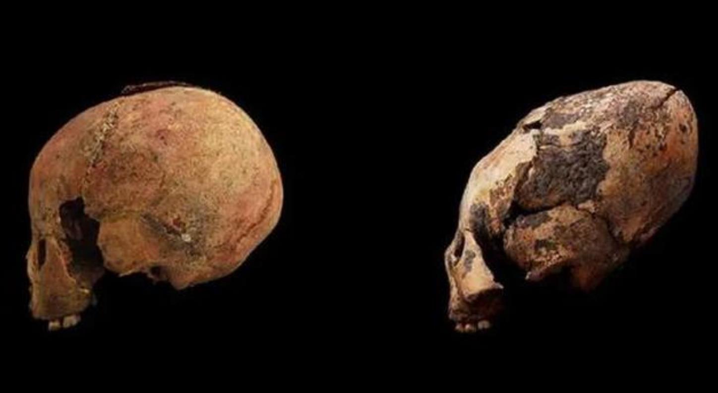 娱乐圈扁头发型,娱乐圈的扁头盘点