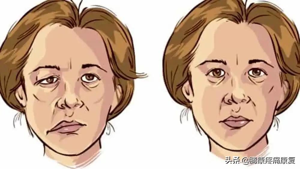 中风偏瘫康复锻炼腿酸困咋回事,中风导致的偏瘫的自我康复锻炼