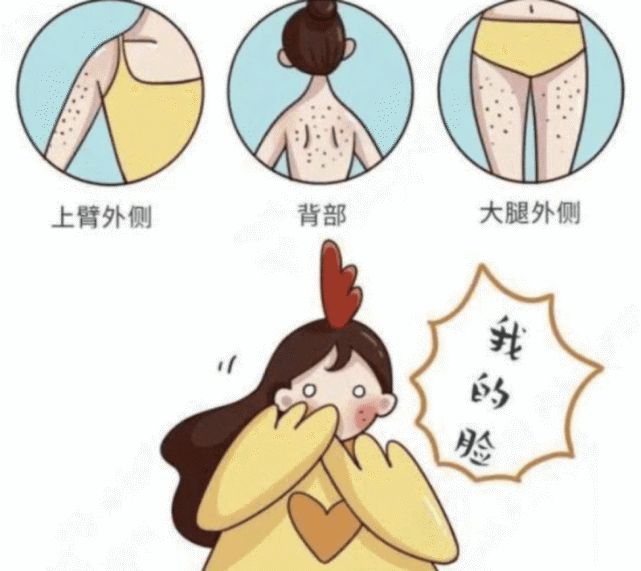 毛囊炎怎么彻底根治最有效的方法,毛囊炎的后果是什么