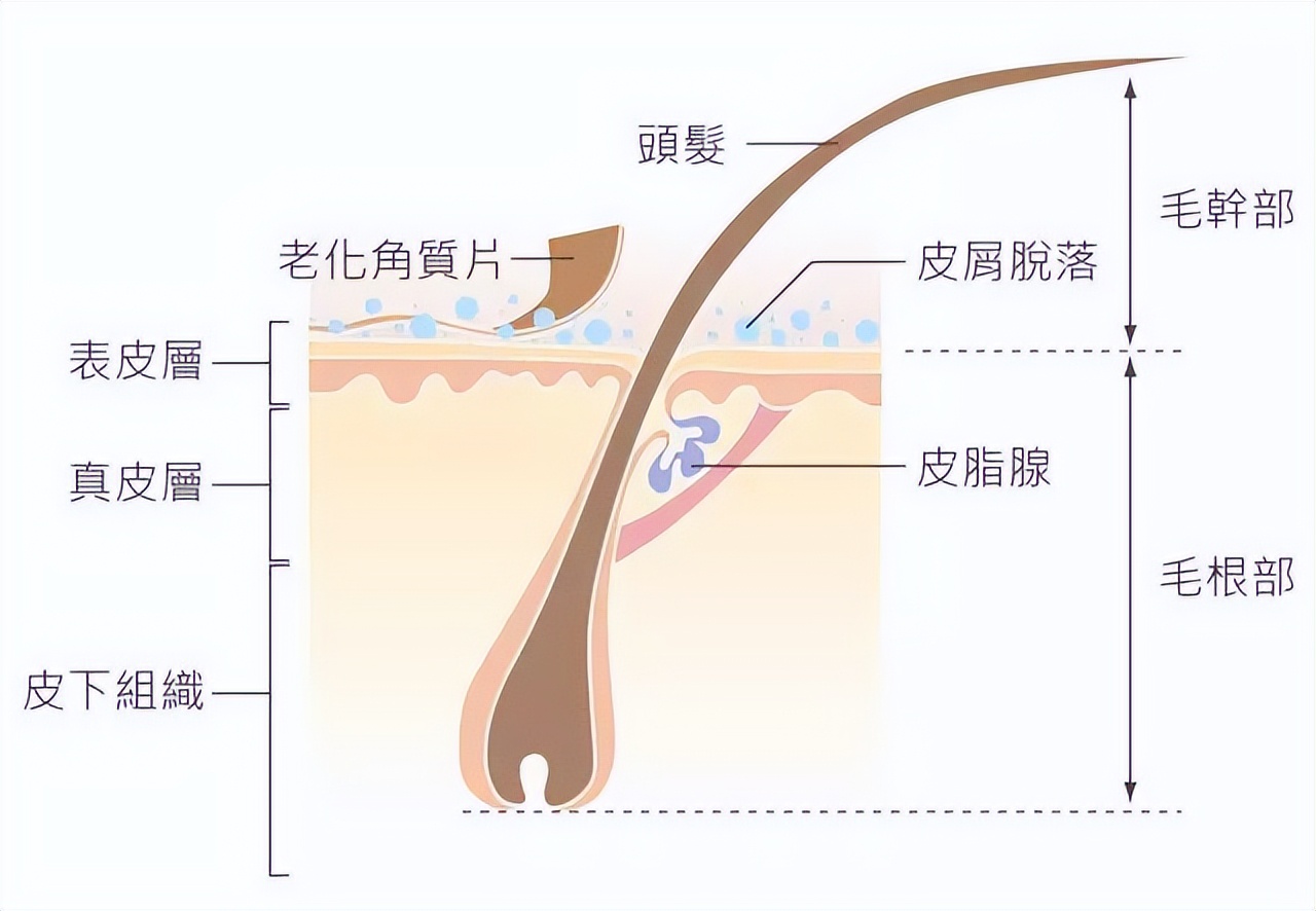 急急急！头皮屑很多，究竟怎么办？看完这篇你有救了