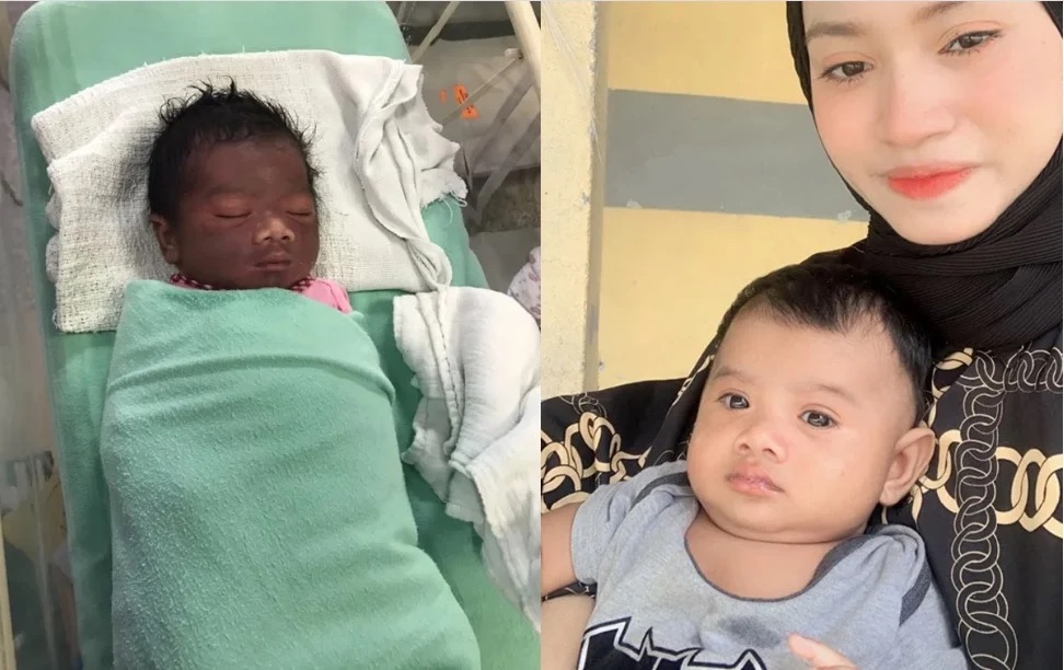 婴儿出生窒息,婴儿卡住急救