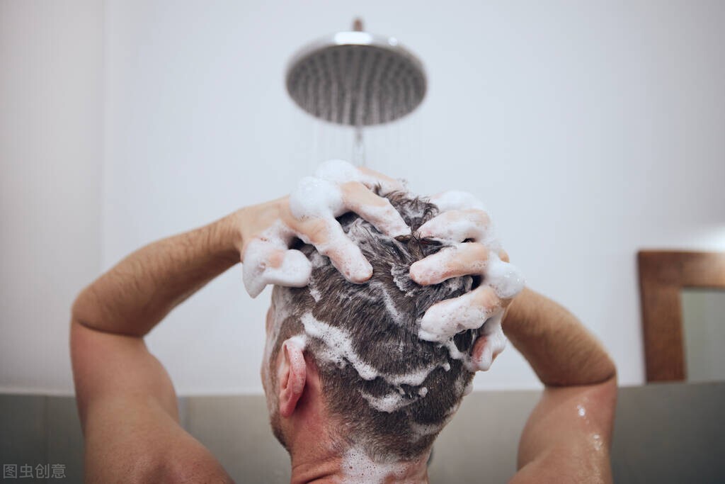 脱发严重应该多洗头还是少洗头,长时间不洗头导致的脱发怎么改善