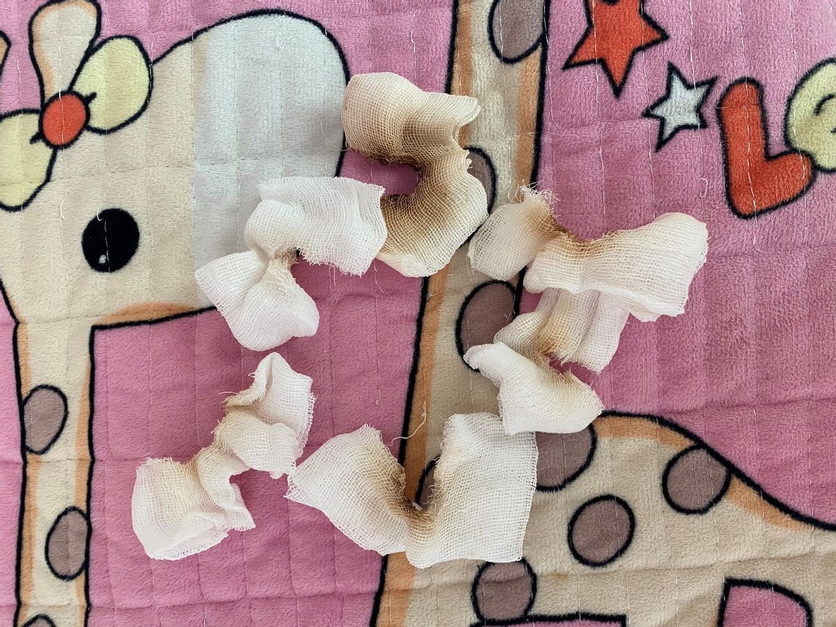 一针70万的救命药后续,70万一针救命药背后完整版