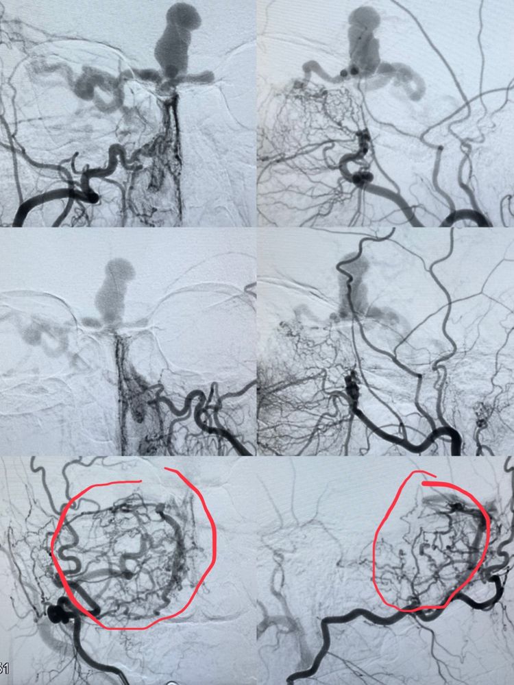 一个值得唠叨几句的病例