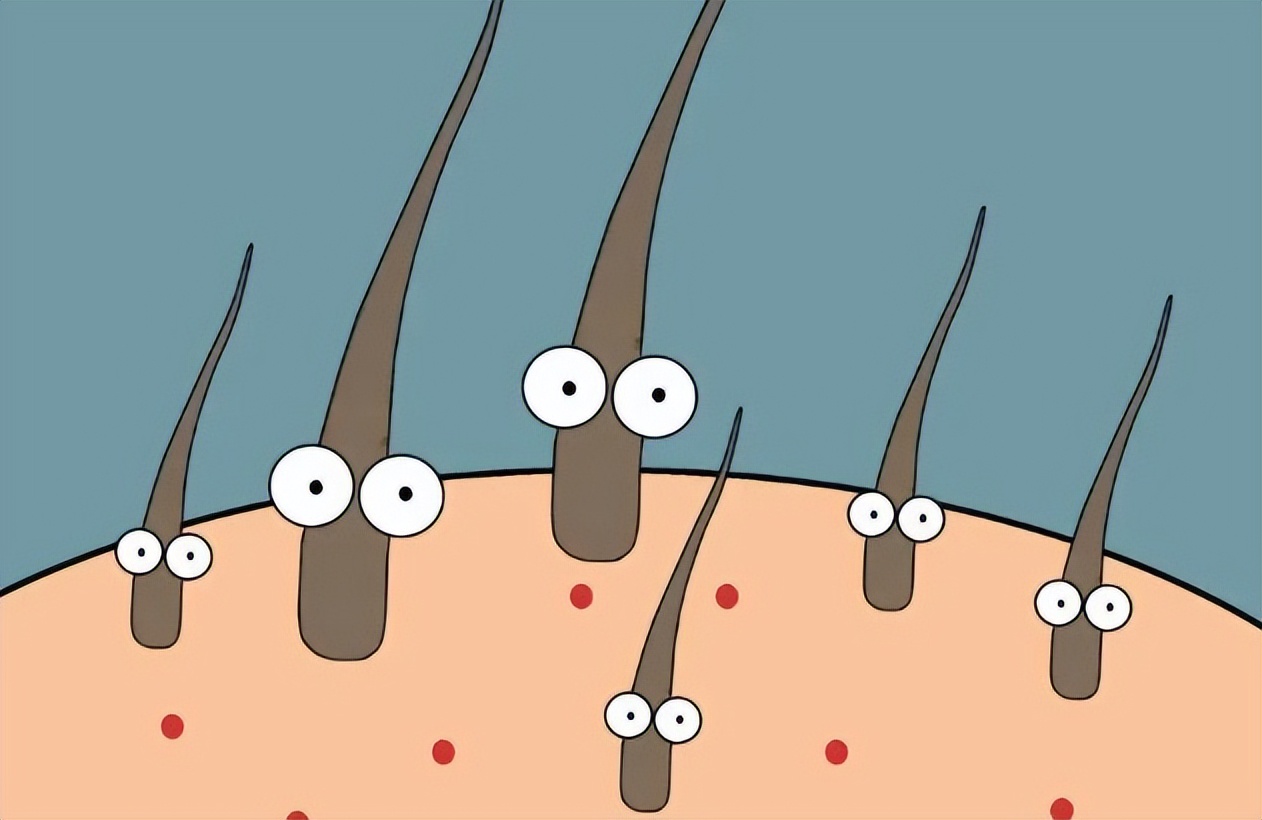 为什么头皮长痘痘和脓包,头皮上长小疙瘩脓包是怎么回事