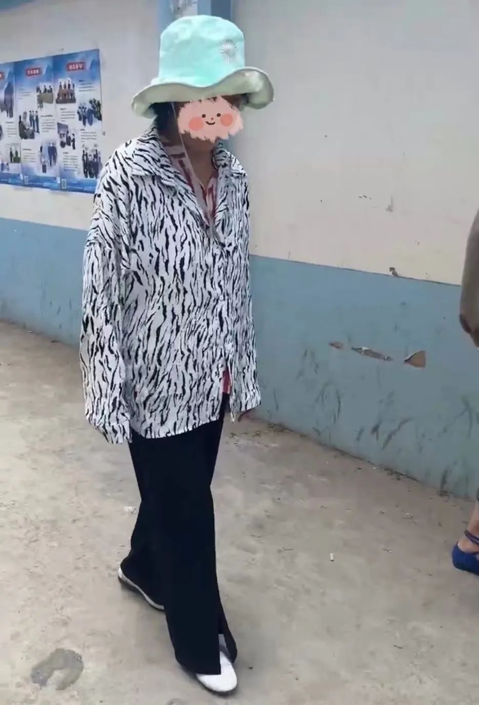 70岁母亲头晕头上长了恶性肿瘤,50多岁阿姨经常头疼