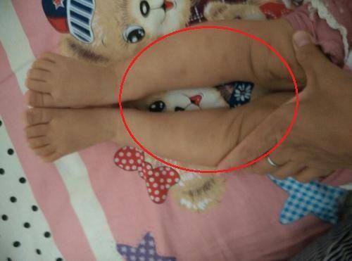 为何我们的娃没欧美的孩子腿直呢？有三类不好的习惯需要纠正