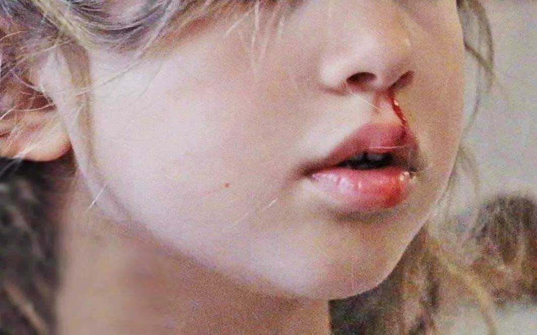 孩子受伤流血妈妈反应,孩子碰伤流鼻血怎么快速止血