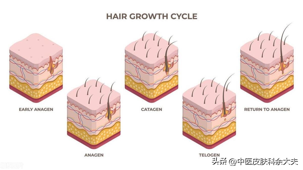 脱发严重时不妨试试以下三招,脱发是不是世界难题