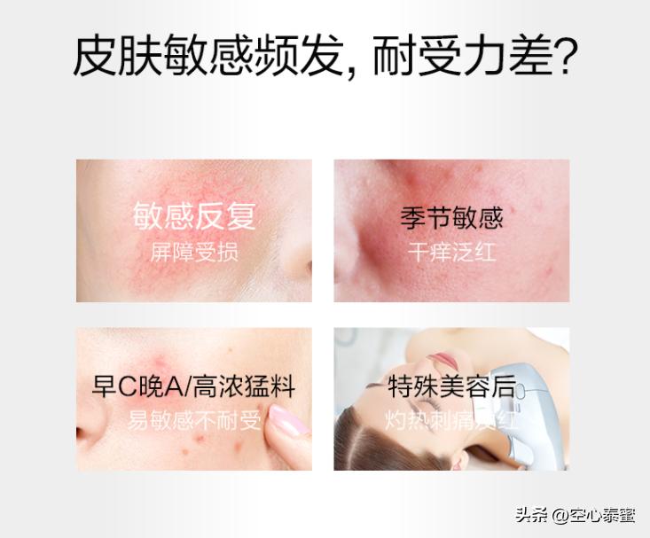 敏感肌面霜薇诺娜特护霜,薇诺娜特护霜痘痘肌推荐吗