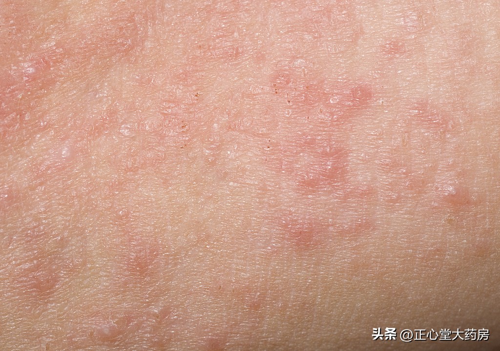 内衣和袜子能一起洗吗,内衣和袜子一起洗会传染脚气吗