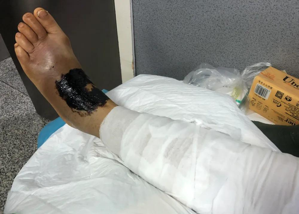 又是蛇！江西老人在被窝里摸到蛇，这种情况该如何处理？