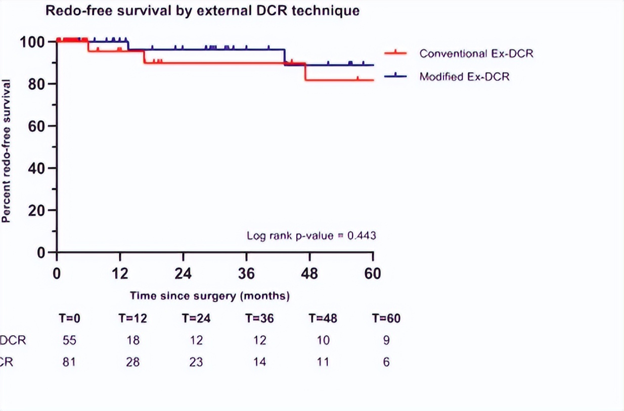 泪囊吻合手术和置管有啥区别,泪囊切除术是几类切口