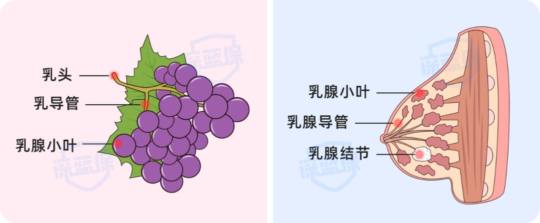 有乳腺结节买保险要告知吗,乳腺结节3-4a能买保险吗