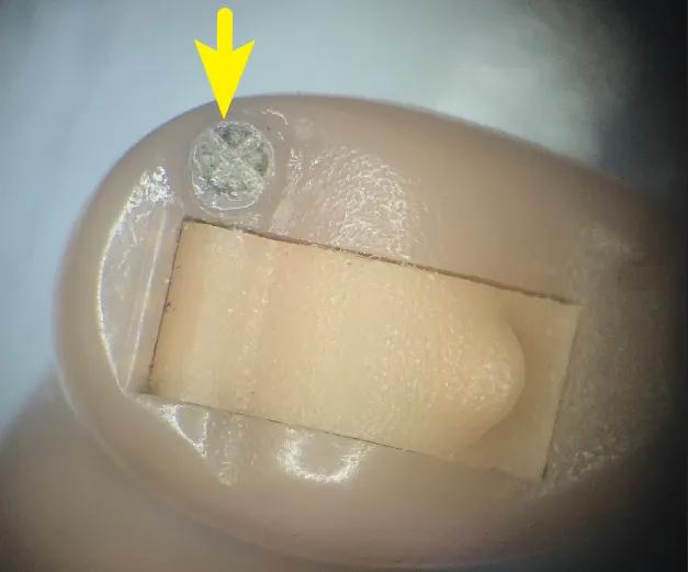 麦克风有异物堵住孔了怎么处理,手机麦克风孔被异物堵了怎么办