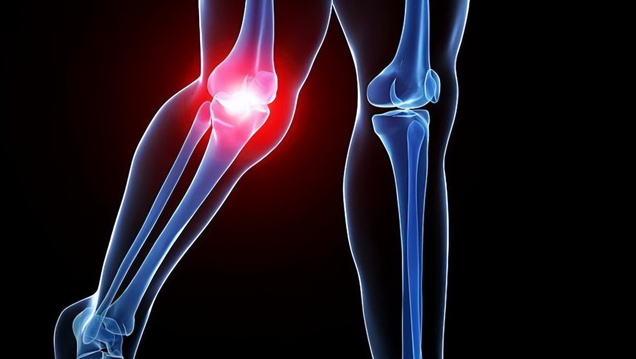 基于气血津液理论,探析阳虚质膝骨性关节炎的中医治疗