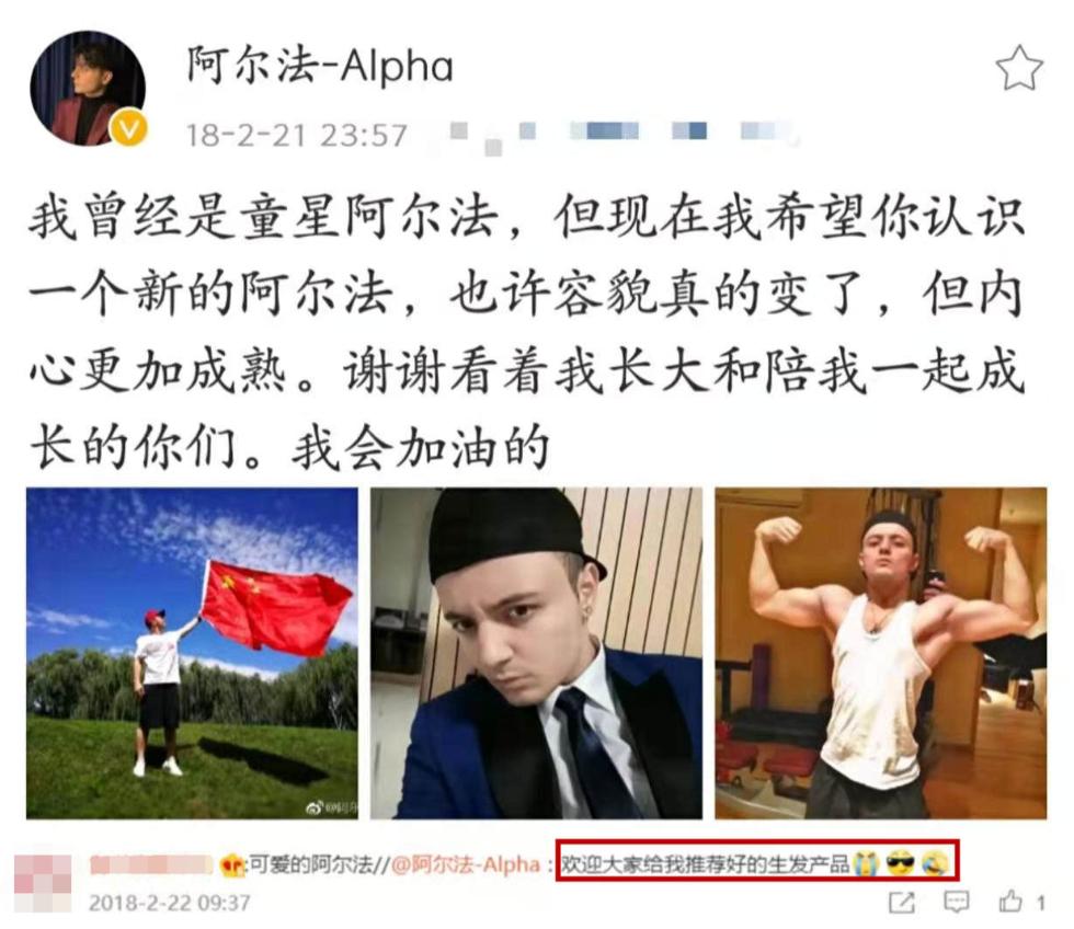 发际线秃的男星,盘点十大秃头男星佩戴假发
