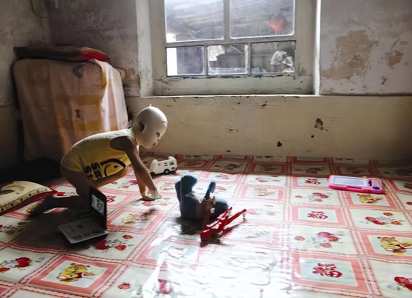 小孩子脸被火烧伤戴着面具,因烧伤带面具的山西小男孩