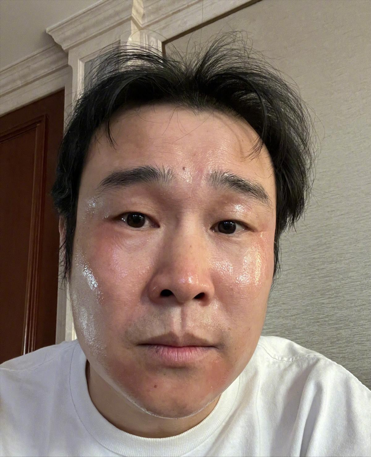 明星艺人确诊阳性,被确诊为阳性的明星