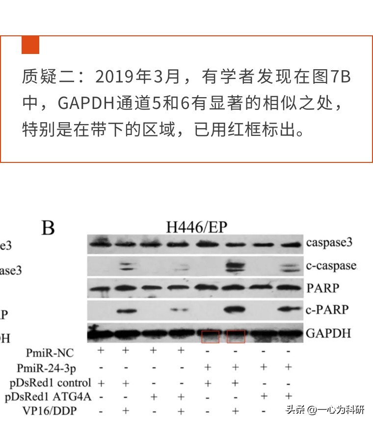 四年内质疑不断，*京大南**学医学院附属金陵医院的早期论文多图重复