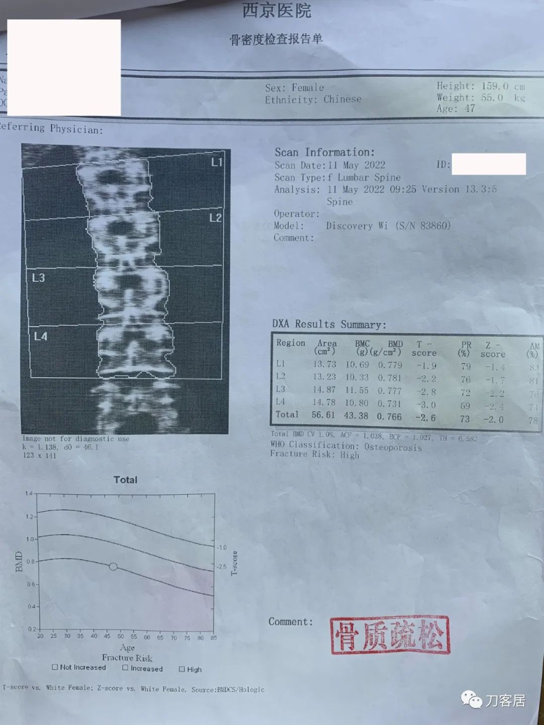 不太贵的一个进口药，从温州跑到西安买，没必要。