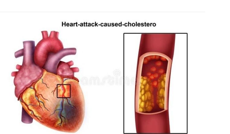 中药奇方三通汤，通心、脑、血管，通全身淤血，散于止痛