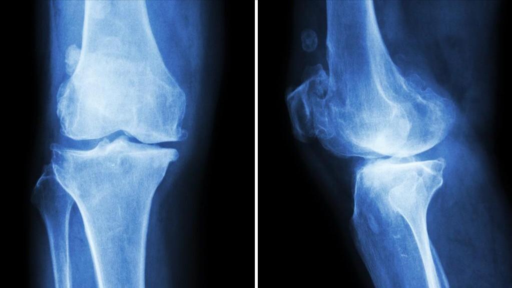 体检查出这十种病不用治疗,真正的医院不建议体检的三种病