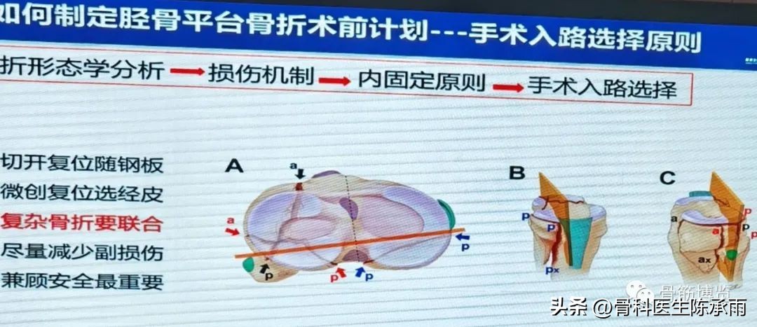 国家卫健委主办的骨创伤专项能力培训项目----下肢损伤学习班
