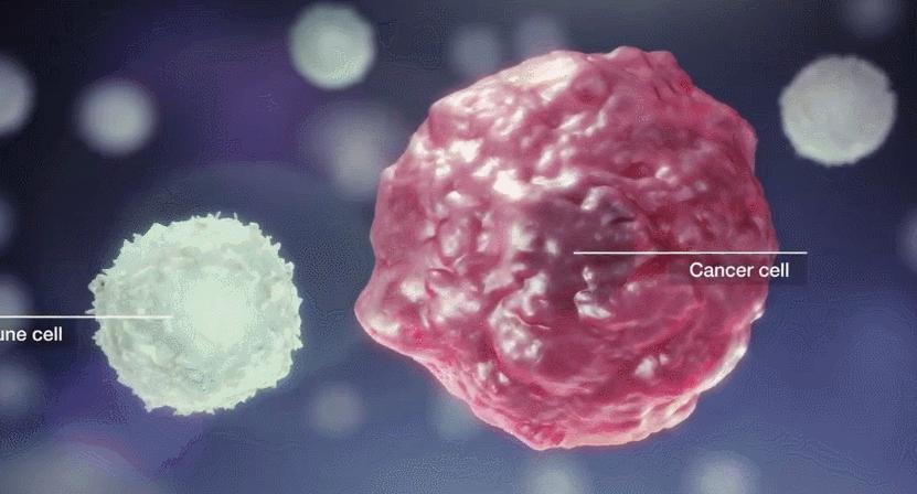 免疫细胞治疗肿瘤真实案例,免疫细胞对肿瘤是否有效好在哪里