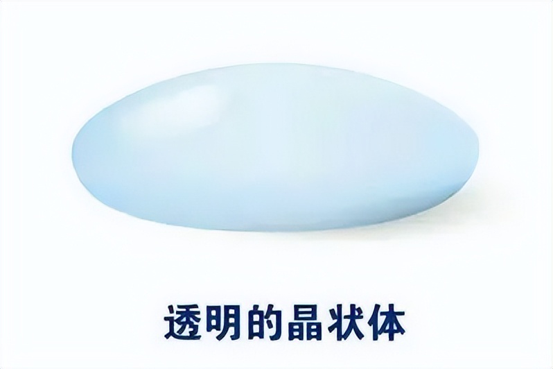 白内障久拖不治成弱视,白内障一直不做手术有什么后果