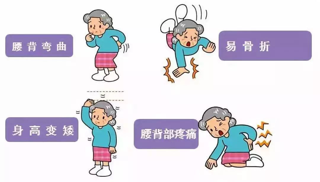 更年期骨关节退化怎么办,女人更年期骨质退变怎么补