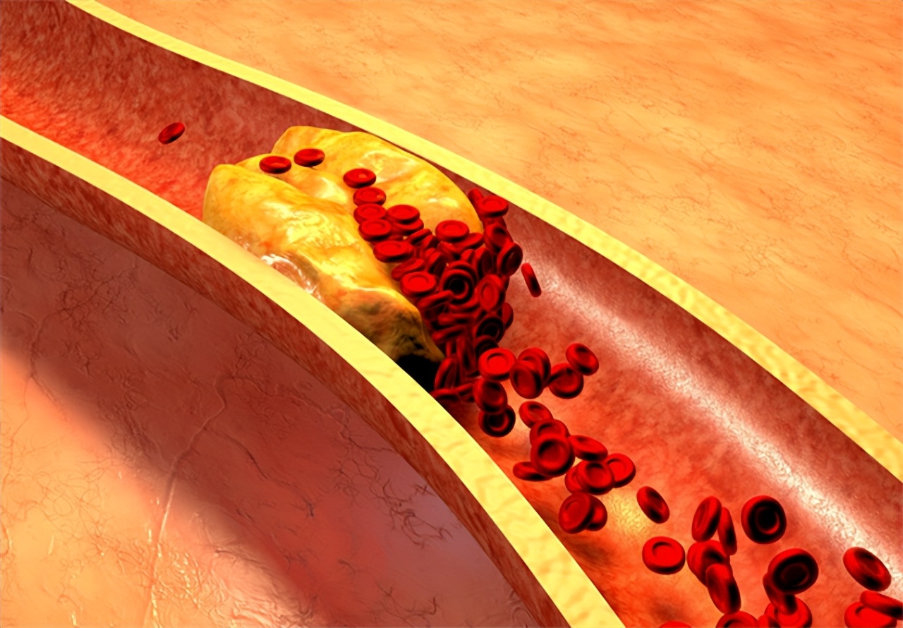 几毛钱的维生素b2治好病,高血压人可以一直吃维生素b2吗