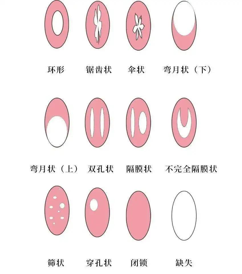 女孩11岁肚子疼肠痉挛怎么回事,13岁女孩肠痉挛应该怎么办