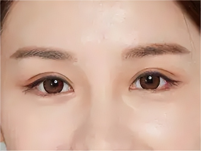 40岁女性眼睛衰老要怎样改善,40岁眼睛衰老怎么办