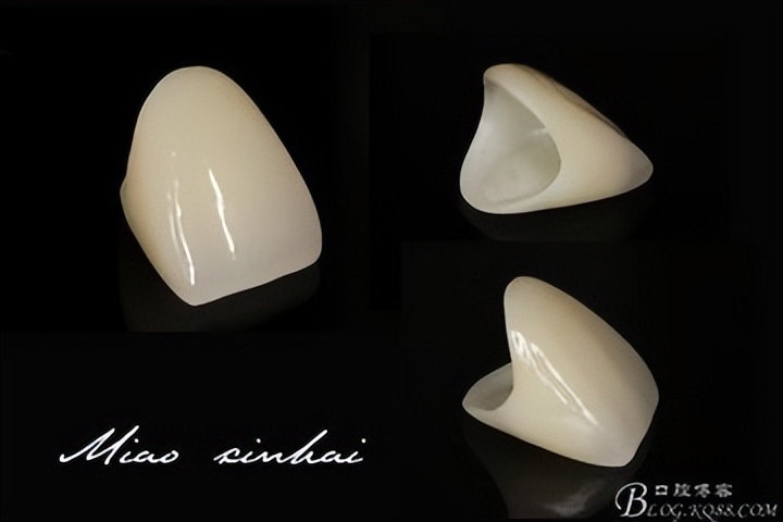 牙齿断了一半怎么处理最好多少钱,牙齿断了一半怕冰怎么处理最好